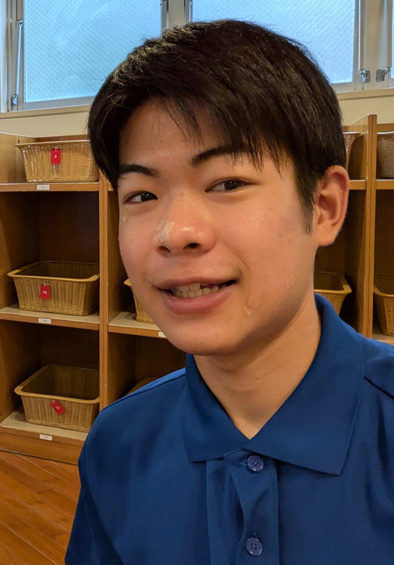 F・Yさん（10代後半）